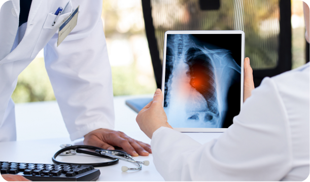 Two doctors looking at a chest x-ray